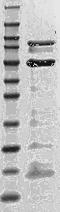 Janus Kinase 2 antibody, TA354829, Origene, Western Blot image 
