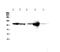 Actinin Alpha 2 antibody, MA1104, Boster Biological Technology, Western Blot image 