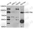 Hydroxysteroid 17-Beta Dehydrogenase 4 antibody, A6187, ABclonal Technology, Western Blot image 