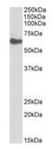 Gamma-Glutamyltransferase 1 antibody, orb99064, Biorbyt, Western Blot image 