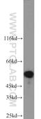 Serine/threonine-protein kinase 11 antibody, 10746-1-AP, Proteintech Group, Western Blot image 