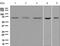 5-Hydroxytryptamine Receptor 2C antibody, ab133570, Abcam, Western Blot image 