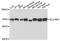 Monocarboxylate transporter 8 antibody, A3636, ABclonal Technology, Western Blot image 