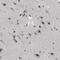 Cerebellar Degeneration Related Protein 2 antibody, HPA018151, Atlas Antibodies, Immunohistochemistry paraffin image 