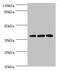 DnaJ Heat Shock Protein Family (Hsp40) Member B5 antibody, A50197-100, Epigentek, Western Blot image 