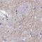 Synaptic vesicular amine transporter antibody, HPA073224, Atlas Antibodies, Immunohistochemistry paraffin image 