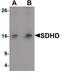 Succinate Dehydrogenase Complex Subunit D antibody, PA5-34387, Invitrogen Antibodies, Western Blot image 