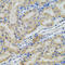 Proprotein Convertase Subtilisin/Kexin Type 9 antibody, A00085, Boster Biological Technology, Immunohistochemistry paraffin image 