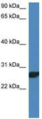 Nedd4 Family Interacting Protein 2 antibody, TA331084, Origene, Western Blot image 