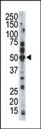 Cyclin Dependent Kinase 15 antibody, AP14131PU-N, Origene, Western Blot image 