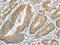 Autophagy Related 10 antibody, CSB-PA828297, Cusabio, Immunohistochemistry paraffin image 