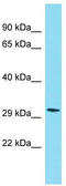 PIH1 Domain Containing 2 antibody, TA334113, Origene, Western Blot image 