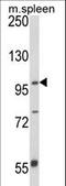 Anoctamin-5 antibody, LS-C156362, Lifespan Biosciences, Western Blot image 
