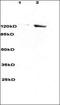 Sterol Regulatory Element Binding Transcription Factor 2 antibody, orb13693, Biorbyt, Western Blot image 