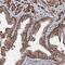 Centrosomal Protein 76 antibody, PA5-58772, Invitrogen Antibodies, Immunohistochemistry paraffin image 