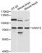 CCR4-NOT transcription complex subunit 2 antibody, STJ114698, St John
