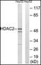 Histone Deacetylase 2 antibody, orb95473, Biorbyt, Western Blot image 