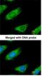 Malic Enzyme 1 antibody, NBP1-32398, Novus Biologicals, Immunofluorescence image 