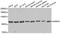 Lysine Demethylase 7A antibody, A8266, ABclonal Technology, Western Blot image 