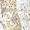 Fibroblast Growth Factor Receptor 1 antibody, A2073, ABclonal Technology, Immunohistochemistry paraffin image 