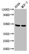 Lysyl Oxidase antibody, LS-C285766, Lifespan Biosciences, Western Blot image 