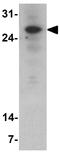 Paired Related Homeobox 1 antibody, GTX17237, GeneTex, Western Blot image 