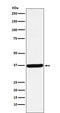 Dimethylarginine Dimethylaminohydrolase 1 antibody, M03136, Boster Biological Technology, Western Blot image 