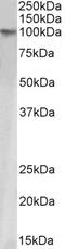 CutA Divalent Cation Tolerance Homolog antibody, 43-485, ProSci, Enzyme Linked Immunosorbent Assay image 