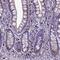 Chromosome 19 Open Reading Frame 48 antibody, NBP1-81210, Novus Biologicals, Immunohistochemistry paraffin image 