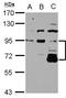 DIS3 Like 3'-5' Exoribonuclease 2 antibody, NBP2-16166, Novus Biologicals, Western Blot image 