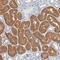 Zinc Finger DHHC-Type Containing 8 antibody, PA5-51931, Invitrogen Antibodies, Immunohistochemistry paraffin image 