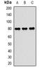 Transporter 2, ATP Binding Cassette Subfamily B Member antibody, orb340765, Biorbyt, Western Blot image 