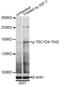 TBC1 Domain Family Member 4 antibody, LS-C750598, Lifespan Biosciences, Western Blot image 