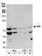 MLLT3 Super Elongation Complex Subunit antibody, A300-595A, Bethyl Labs, Western Blot image 