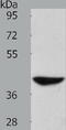 Alcohol Dehydrogenase 1B (Class I), Beta Polypeptide antibody, TA323599, Origene, Western Blot image 