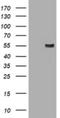 Amylase Alpha 2B (Pancreatic) antibody, NBP2-45492, Novus Biologicals, Western Blot image 