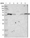 Rap1 GTPase-GDP Dissociation Stimulator 1 antibody, NBP1-87027, Novus Biologicals, Western Blot image 