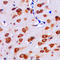 rIPK1 antibody, LS-C353526, Lifespan Biosciences, Immunohistochemistry paraffin image 
