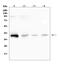 RP2 Activator Of ARL3 GTPase antibody, A01923-1, Boster Biological Technology, Western Blot image 