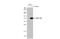 BRISC And BRCA1 A Complex Member 1 antibody, GTX629878, GeneTex, Western Blot image 
