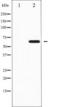 Ezrin antibody, TA326014, Origene, Western Blot image 