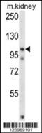 Follistatin Like 5 antibody, 57-116, ProSci, Western Blot image 