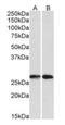 Nicotinamide N-Methyltransferase antibody, orb198497, Biorbyt, Western Blot image 