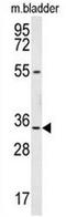 Leucine Rich Repeat Containing 18 antibody, AP52520PU-N, Origene, Western Blot image 