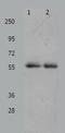 Matrix metalloproteinase-17 antibody, TA322335, Origene, Western Blot image 