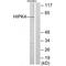 Homeodomain Interacting Protein Kinase 4 antibody, A12886, Boster Biological Technology, Western Blot image 