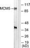 Minichromosome Maintenance Complex Component 5 antibody, TA312325, Origene, Western Blot image 