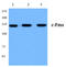 FMS antibody, AP20219PU-N, Origene, Western Blot image 