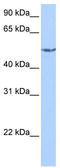Carnitine O-Acetyltransferase antibody, TA336220, Origene, Western Blot image 