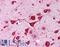 Calsenilin antibody, LS-B249, Lifespan Biosciences, Immunohistochemistry paraffin image 